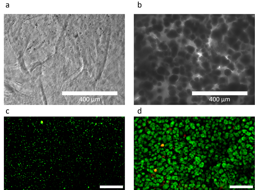 Microorganism growth control in 3D. a) Microscope image of P. pastoris within a 3D printed alginate bioink immediately after crosslinking. b) Image of a P. pastoris laden hydrogel after one day of culture showing microcolony formation. c, d) Fluorescence microscopy of a live (green)/dead (red) stained 3D printed microbial construct, immediately after crosslinking (c), and after three days of culture (d). scale bars 500 µm. Microorganism growth control in 3D. a) Microscope image of P. pastoris within a 3D printed alginate bioink immediately after crosslinking. b) Image of a P. pastoris laden hydrogel after one day of culture showing microcolony formation. c, d) Fluorescence microscopy of a live (green)/dead (red) stained 3D printed microbial construct, immediately after crosslinking (c), and after three days of culture (d). scale bars 500 µm.